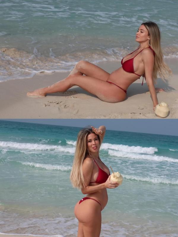 Karius anh 4